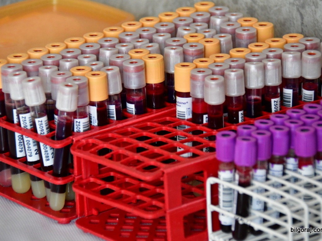 Pobór krwi w Łukowej. Epidemia nie zatrzymała krwiodawców (FOTO)
