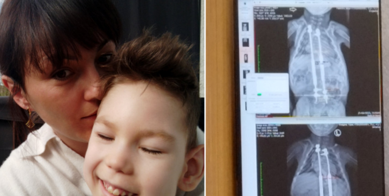 Kubuś Pawęzka potrzebuje Twojego wsparcia. Chłopczyk znów potrzebuje pomocy