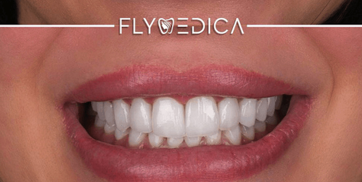 Źródło: flymedica.