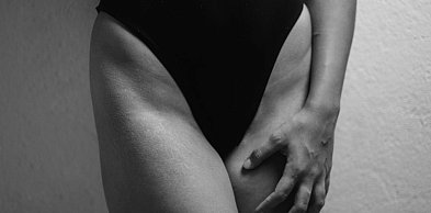 Skóra, która nie utrzymuje stabilności podczas zmiany objętości tkanek