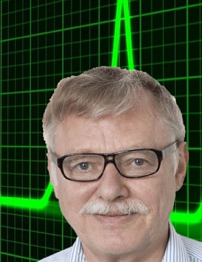 KRUS zachęca do badań profilaktycznych. Już w poniedziałek badania mammograficzne-58656